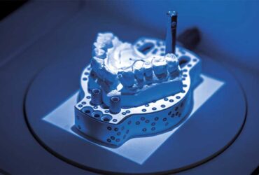Digital Dentistry in Mississauga