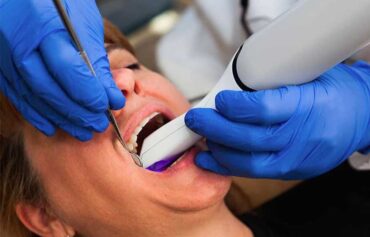 Laser Dentistry in Mississauga