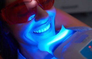 Teeth Whitening in Mississauga