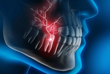 Emergency Dentist in Mississauga